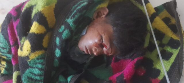 मकान गिरने से एक ही परिवार के पांच सदस्य घायल