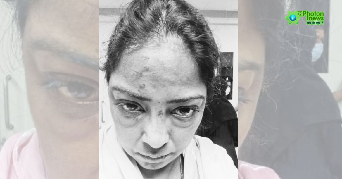 Jamshedpur Ex-Husband Attack