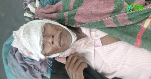 Palamu Witchcraft Attack Palamu Witchcraft Attack