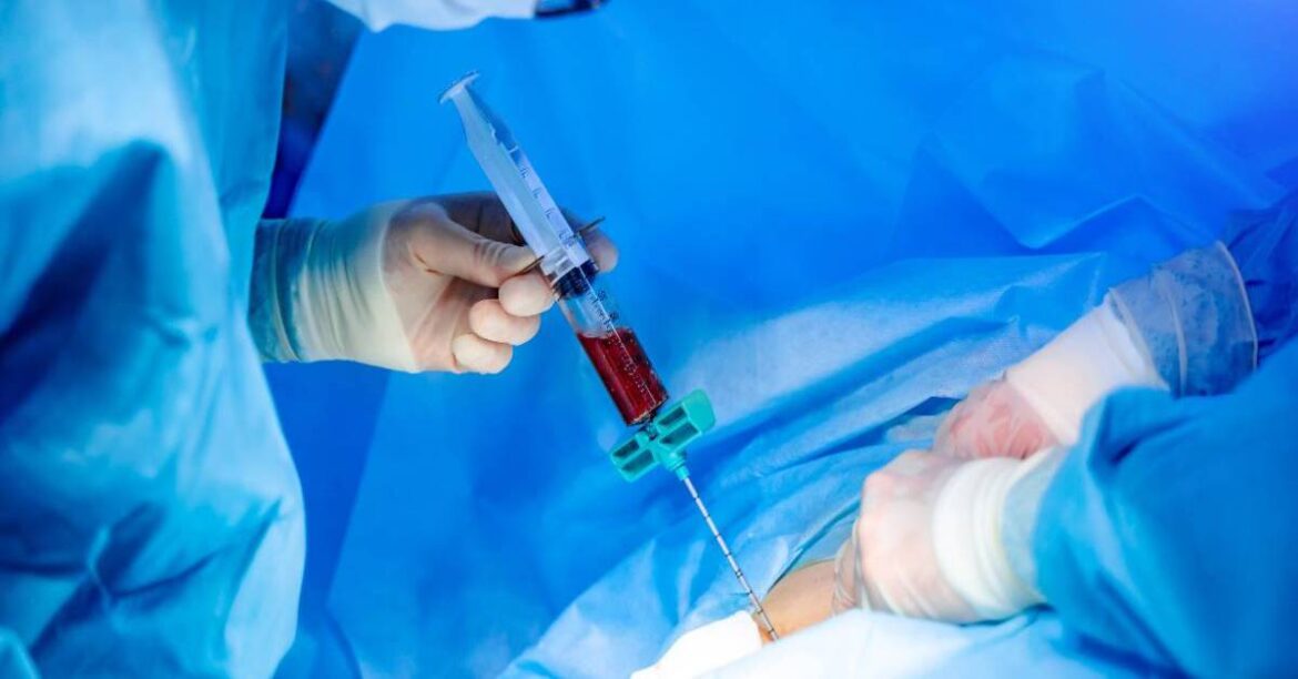 bone-marrow-transplant