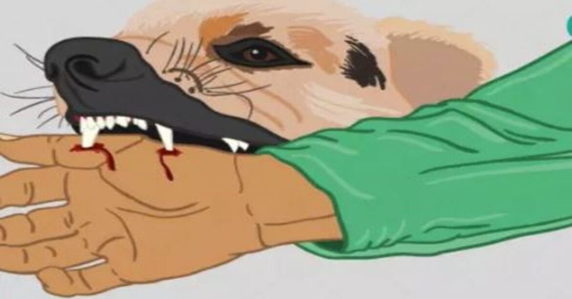 डॉग बाइट