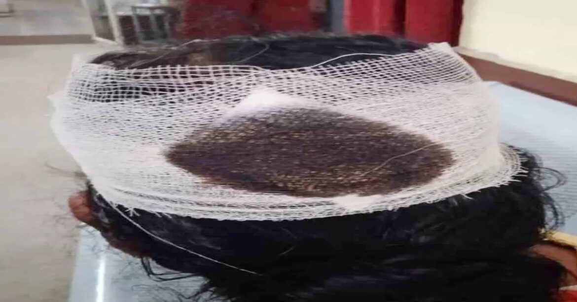 चेन्नई में नेशनल यूथ फेस्टिवल के दौरान स्टेज का लोहे का हिस्सा गिरने से बीबीएमकेयू की दो छात्राएं गंभीर रूप से घायल, अस्पताल में इलाज जारी।