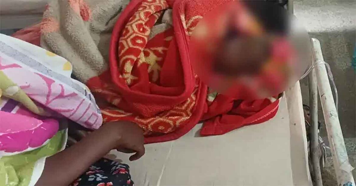 Latehar Bee Attack